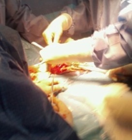 surgery